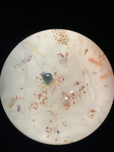 Plankton